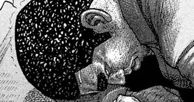 第３７３話　結石のトラッカー